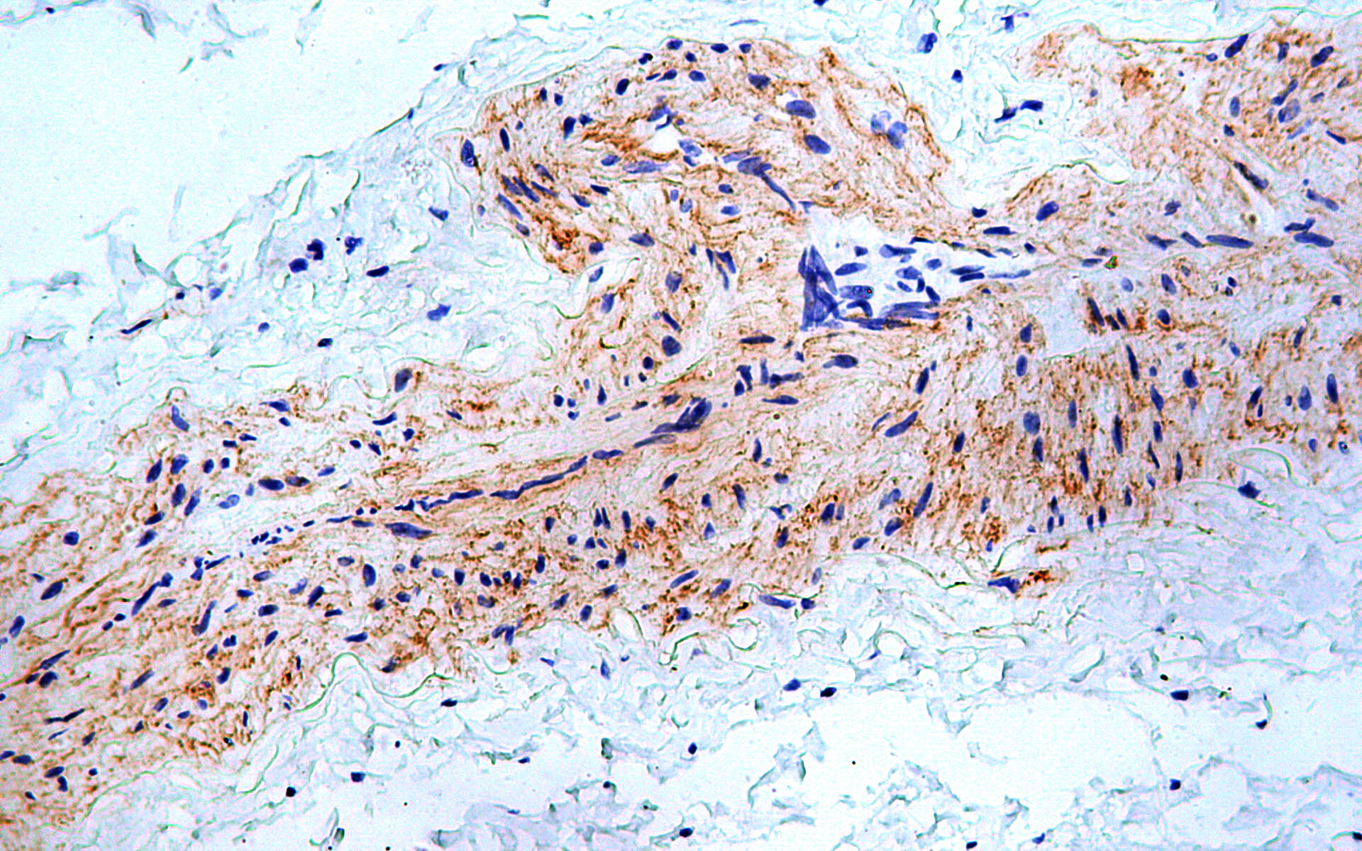 IHC - Collagen Type IV AD80286-010